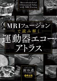 【5月中旬発売予定】
MRIフュージョンで読み解く 運動器エコーアトラスの書影